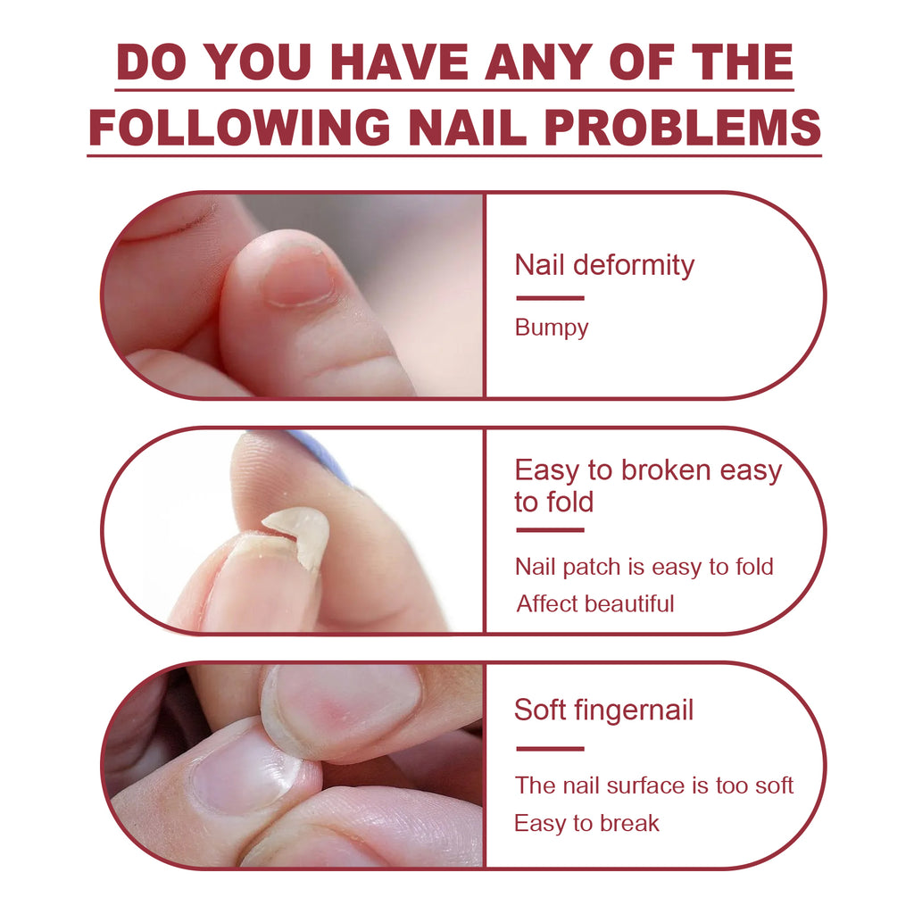 Jaysuing Fiber Extension Gel (20ml) Nail Anti-Crack Nail Art Nail Light Therapy Extension Gel Burst Nail Gel